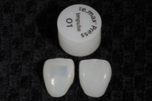 Металлические Коронки морально и физически устарели. Виды коронок 05 Металлические Коронки морально и физически устарели. Виды коронок 05